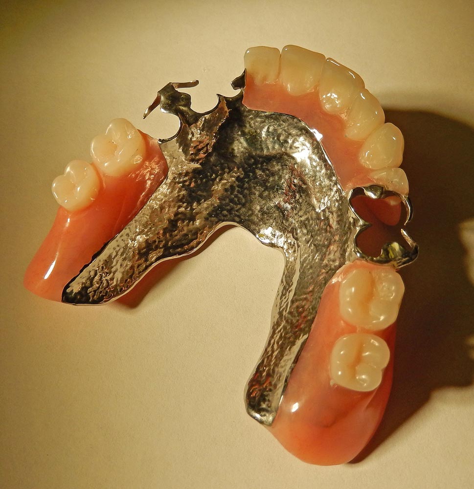 Types of Dentures | Oakridge Denture Centre | Calgary Denture Clinic